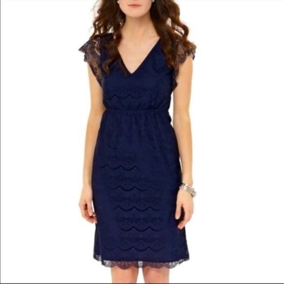 Fossil Dresses & Skirts - Fossil Penny Lace Dress M Bohemian Cap Sleeve V-Neck Elastic Waist Scallop Navy